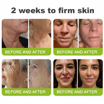 Helps Improve the Look of Fine Lines & Texture — Gentle Retinol Night Cream