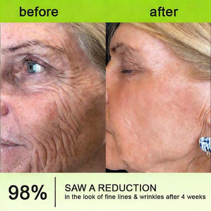 Helps Improve the Look of Fine Lines & Texture — Gentle Retinol Night Cream