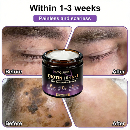 🔥LAST DAY 50% OFF - QIAWI® Biotin 10-in-1 Skin Restoration Cream