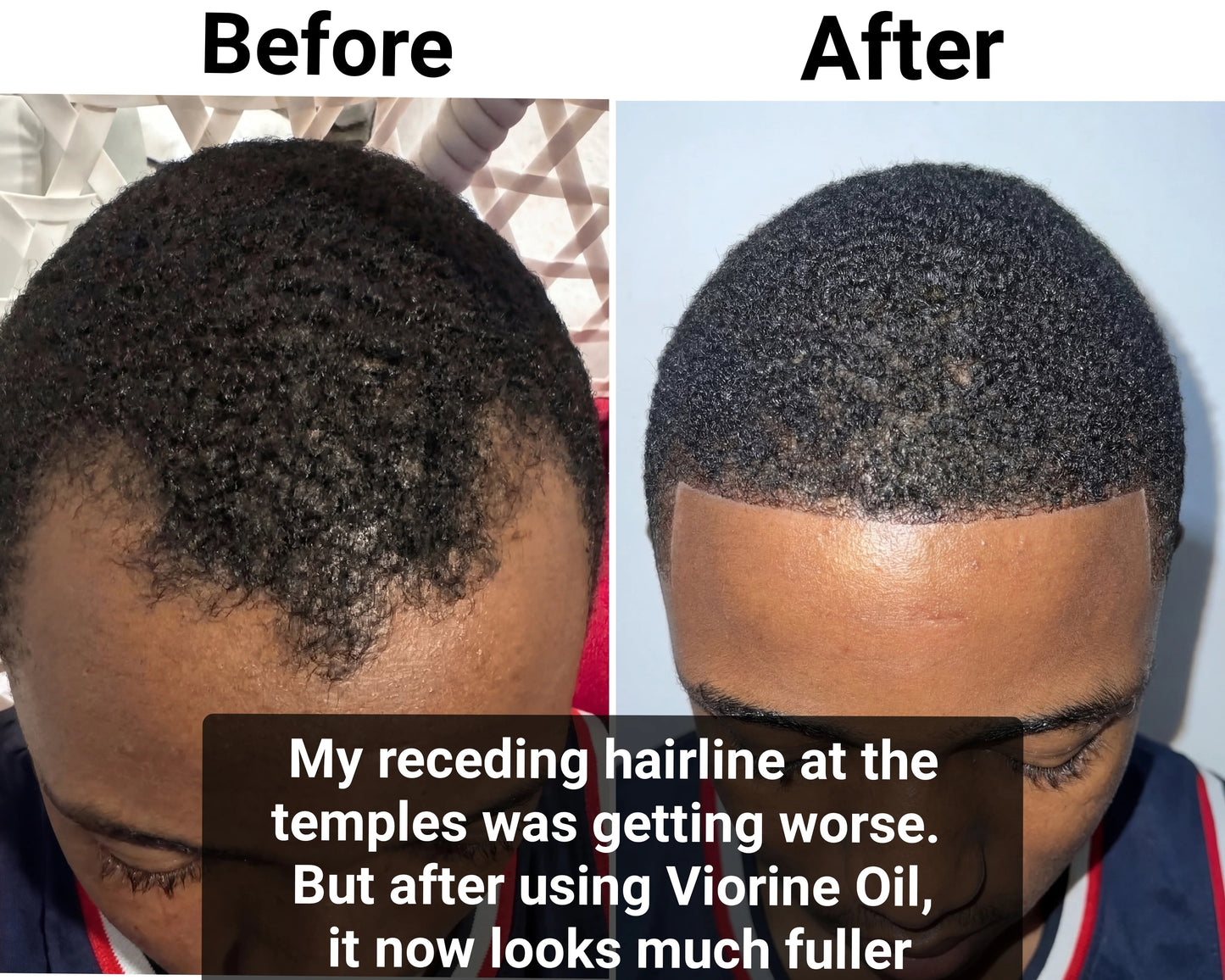Batana Hair Oil - 50ML