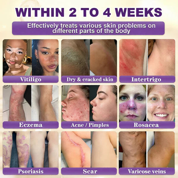 Made and Shipped from USA ✨Biotin 10-in-1 Skin Restoration Cream 🍀