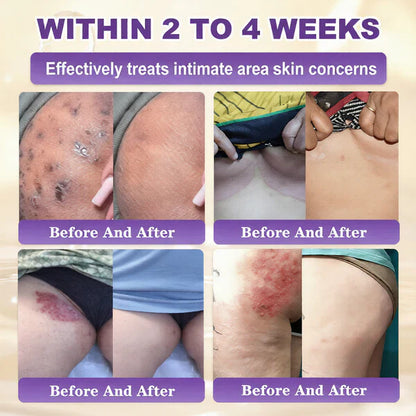 Made and Shipped from USA ✨Biotin 10-in-1 Skin Restoration Cream 🍀