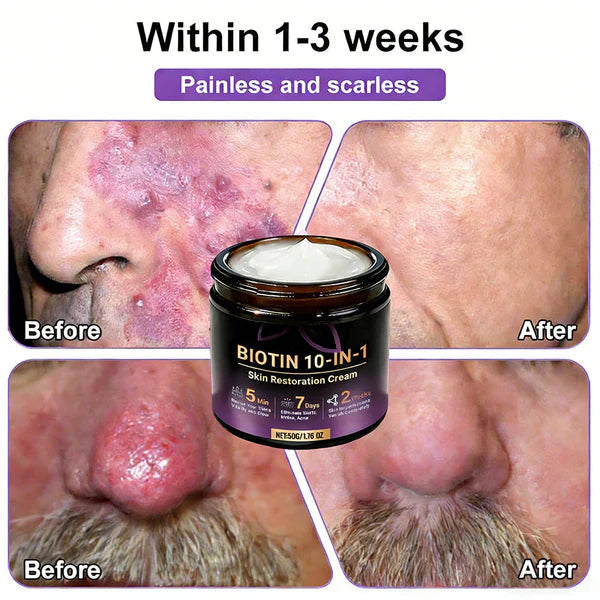 Made and Shipped from USA ✨Biotin 10-in-1 Skin Restoration Cream 🍀