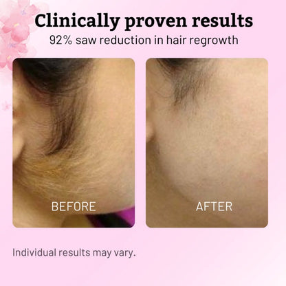 🌿Beauty Cyperus Rotundus Oil for Natural Permanent Hair Reduction