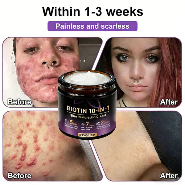 Made and Shipped from USA ✨Biotin 10-in-1 Skin Restoration Cream 🍀