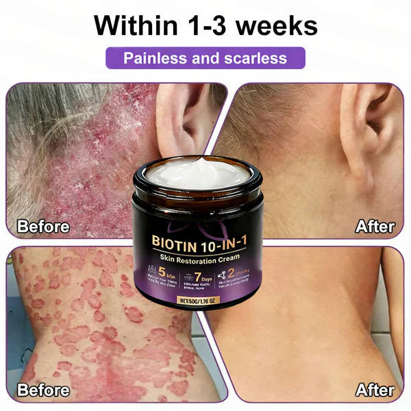 Made and Shipped from USA ✨Biotin 10-in-1 Skin Restoration Cream 🍀