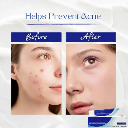 ✨Get clear, radiant skin quickly - Enjoy a 49% discount - ✨Ultimate skincare formula + hyaluronic acid - Suitable for all ages