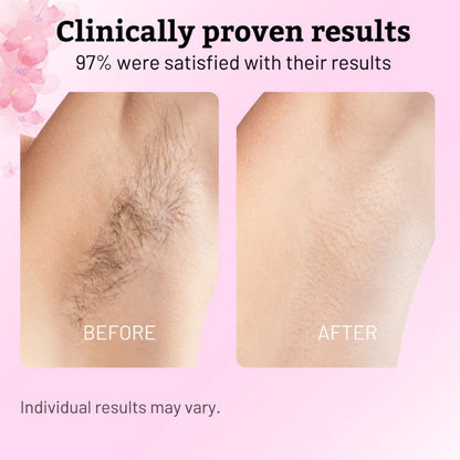 🌿Beauty Cyperus Rotundus Oil for Natural Permanent Hair Reduction