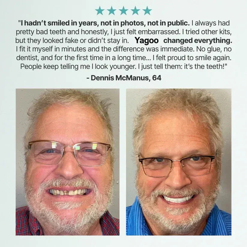 "🎁Ends Today: 70% OFF! ⏰Yagoo™ Medical Full Denture with Strong Suctiond🦷Obtain American Dental Association (ADA) Certification