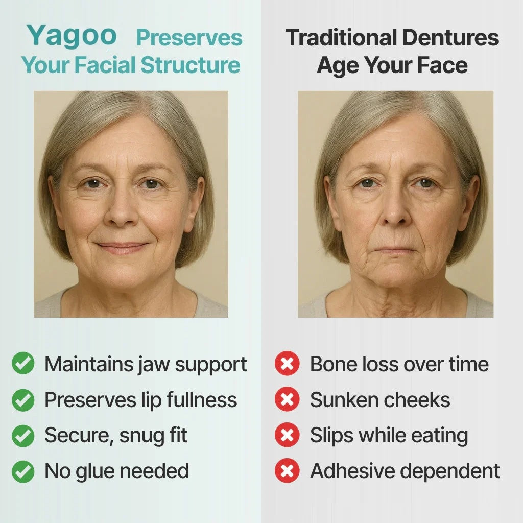 "🎁Ends Today: 70% OFF! ⏰Yagoo™ Medical Full Denture with Strong Suctiond🦷Obtain American Dental Association (ADA) Certification