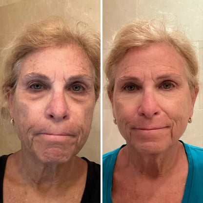 🔥Final 3 Hours : Only Limited Stock Left💖ALL-IN-ONE BALM FOR UNDER-EYE RENEWAL