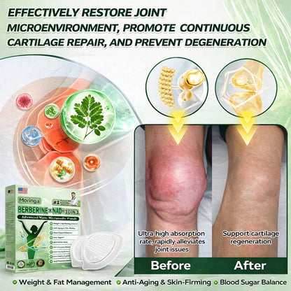 [Boutique officielle]🌲| Moringa · Berberine × NAD+ 10-in-1 Advanced Nano Microneedle Patch 🇬🇧|Backed by science | 10-in-1 formula | Results in 7 days ⏳