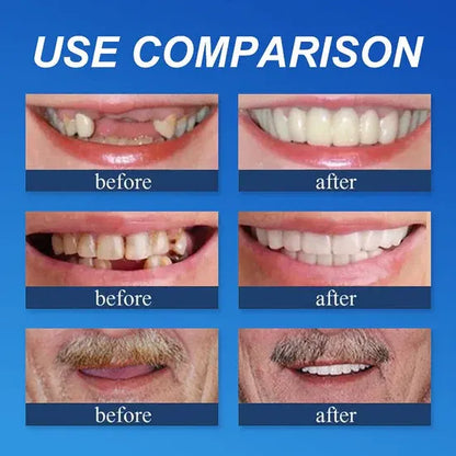 "🎁Ends Today: 70% OFF! ⏰Yagoo™ Medical Full Denture with Strong Suctiond🦷Obtain American Dental Association (ADA) Certification
